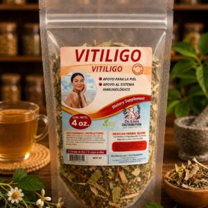 Vitiligo