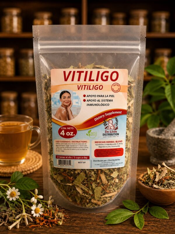 Vitiligo